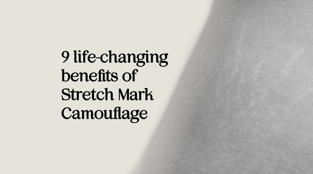 Benefits of Stretch Mark Camouflage